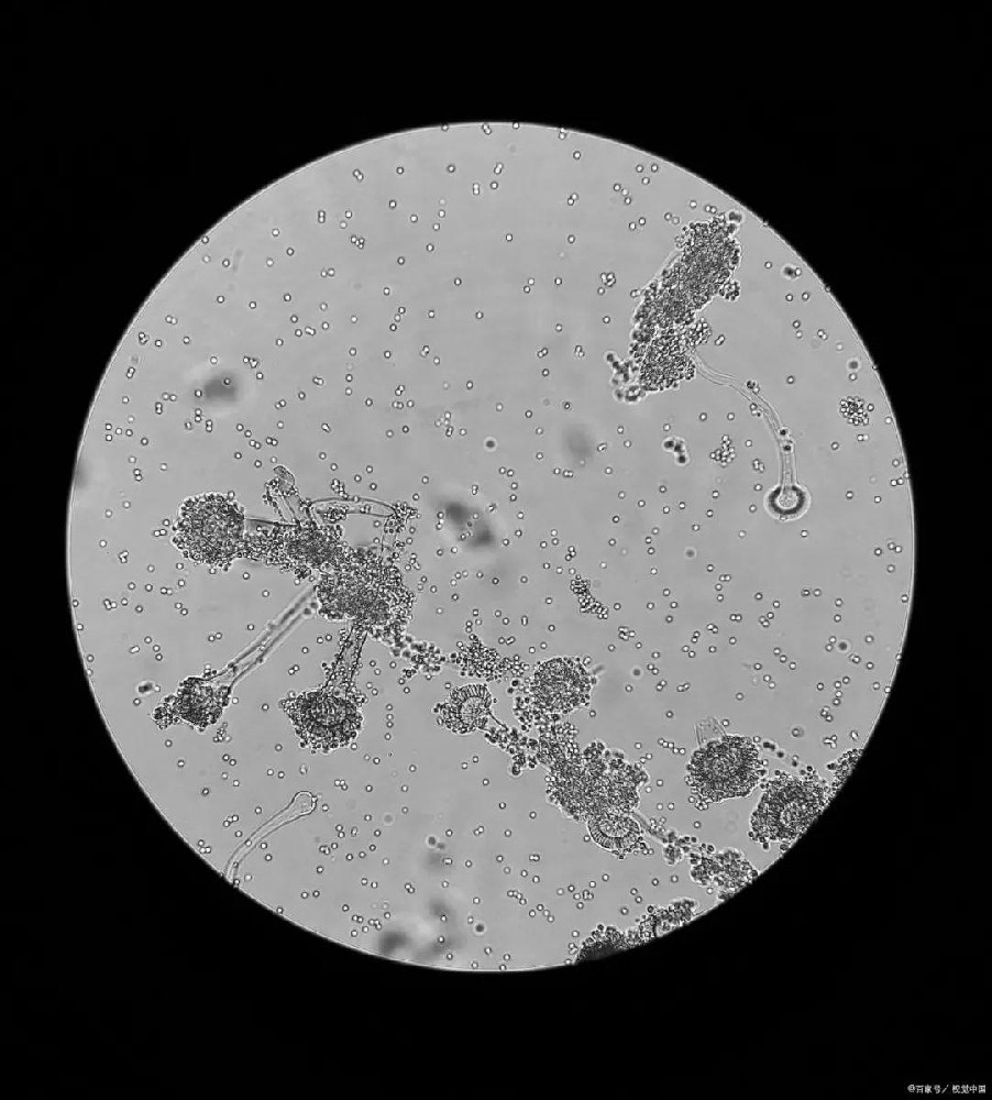 ?如何進(jìn)一步提高微生物菌群的活性和多樣性？